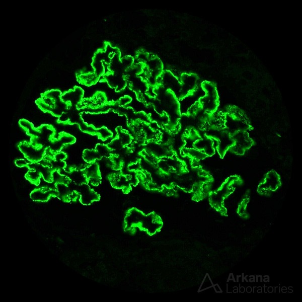 Immunohistochemical staining for PLA2R