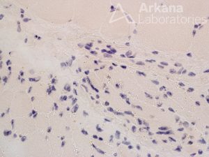 biopsy of skeletal muscle tissue at Arkana Laboratories