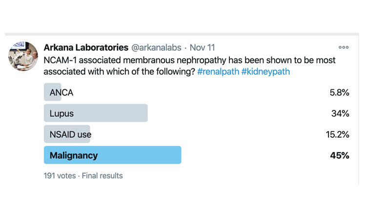 NCAM-1, NCAM-1 associated membranous nephropathy, PLA2R, Twitter Poll, Arkana Laboratories