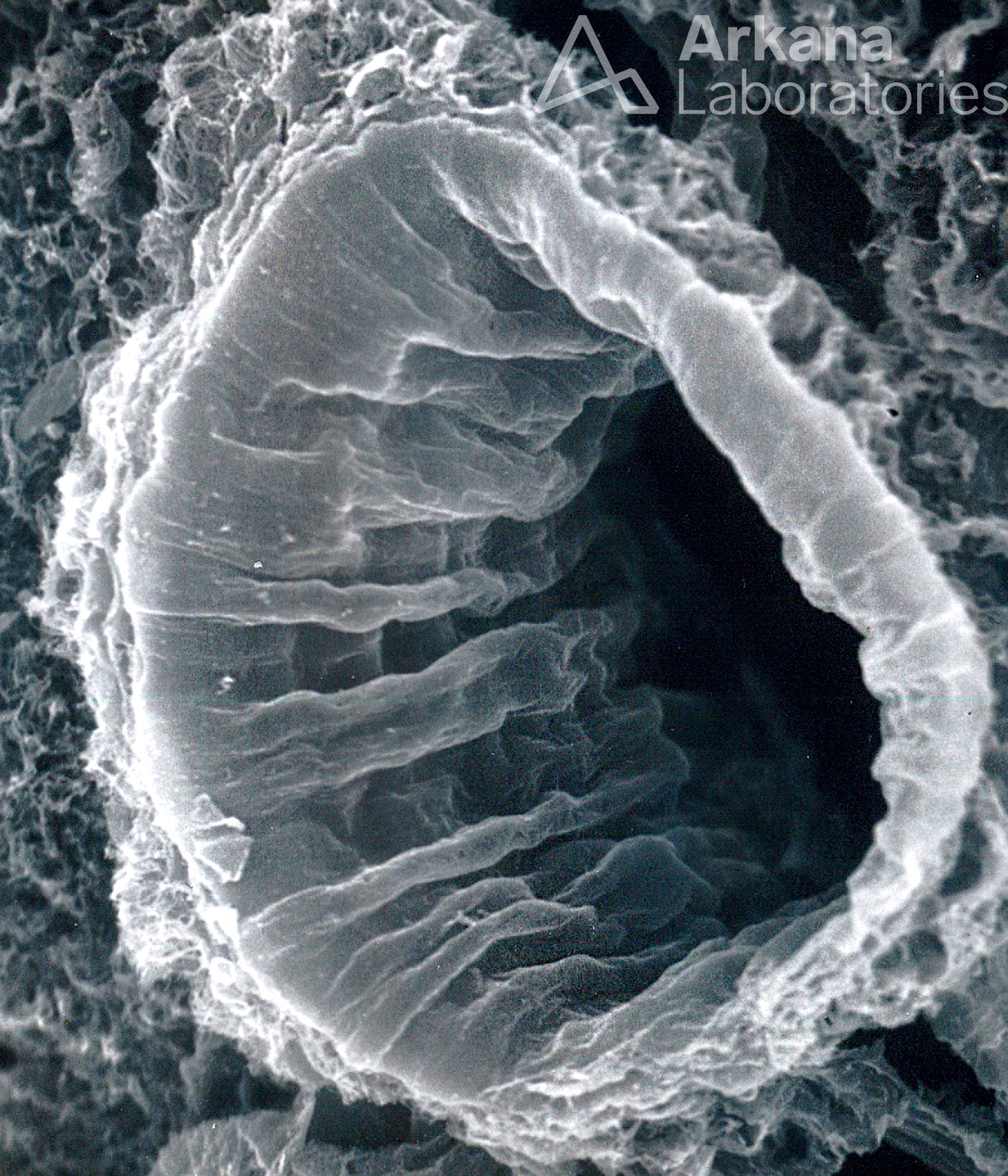 Corrugated Lumen of a Renal Artery, bonsib, renal pathology, eyescandy, arkana laboratories