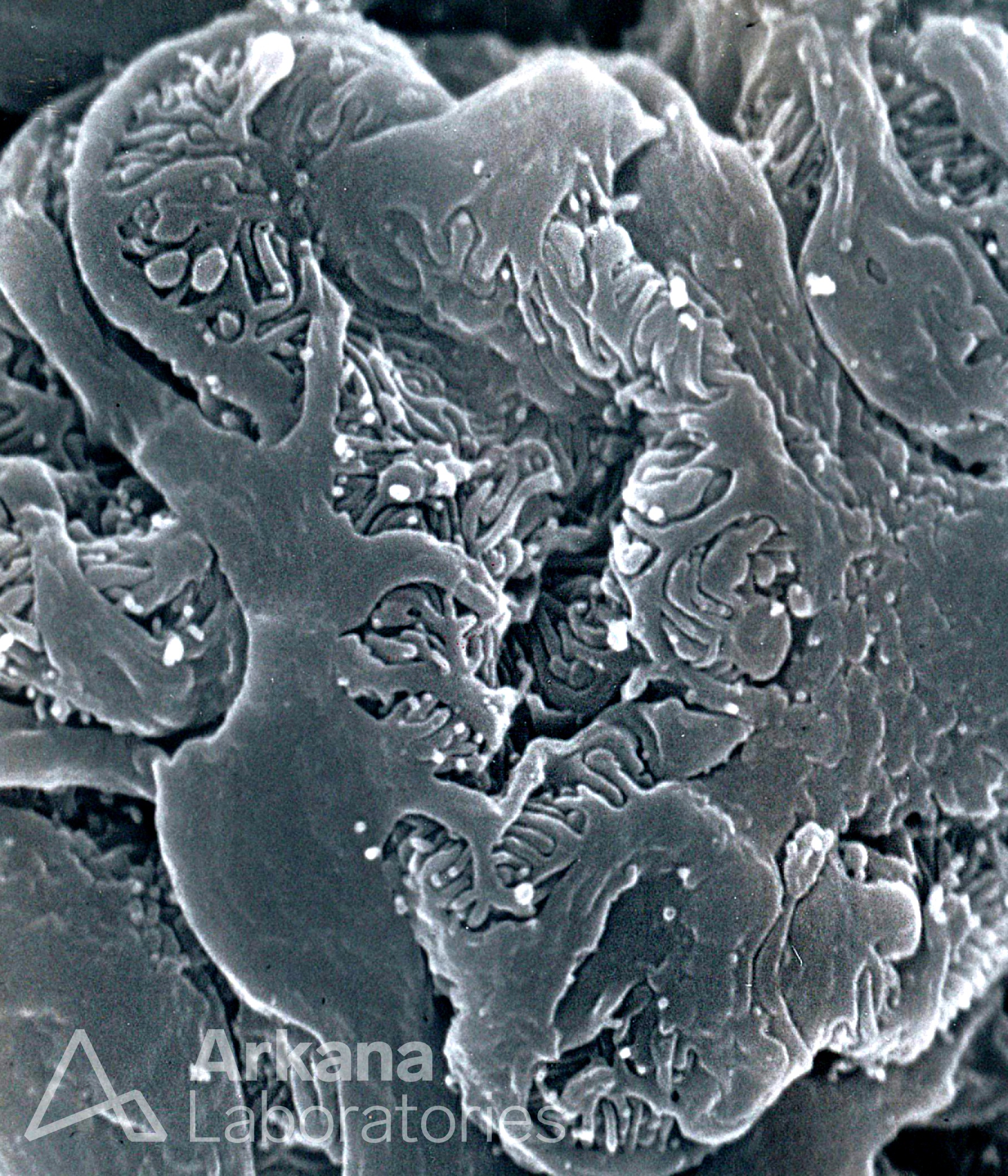 Scanning EM of a Proteinuric Glomerulus, eyescandy, renal pathology, arkana laboratories