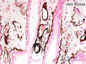 positive Von Kossa stain