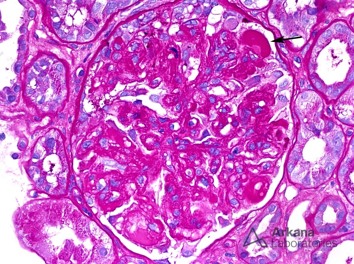 Vascular Endothelial Growth Factor