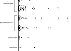 Concentration of male Mc in female human brain regions