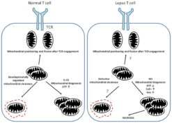 Mitochondrial homeostasis in a normal and a lupus T cells