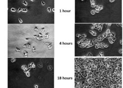 Naegleria fowleri exposure to a commercial saline solution designed for nasal irrigation