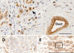 Expression and localization of claudin-2 in the human pancreas using mouse anti-claudin-2 antibodies based on rs12688220 genotype