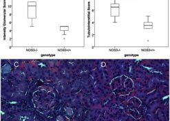 Glomerular and tubulointerstitial pathology is greater in NOSe−/− mice