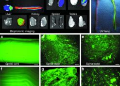 Green fluorescent protein (GFP) expression derived from intravenous administration of an adeno-associated virus (AAV9) vector