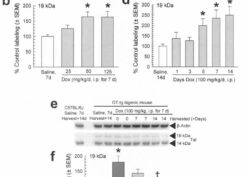 Doxycycline-induced Tat1-86 protein expression in GT-tg mouse whole-brain