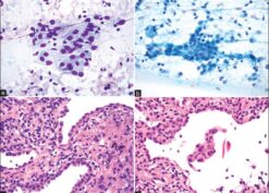 Type II pneumocytes