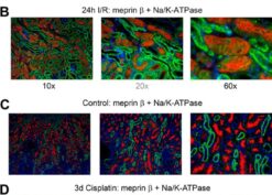 Meprin A distribution in kidneys of mice subjected to ischemia-reperfusion or cisplatin injury