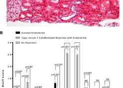 Morphologic phenotypes in isolated endarteritis and control groups