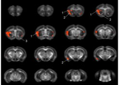 Conditional Tat Protein Expression Induces White and Gray Matter FA Reductions