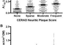 Absorbance cm2 of gray matter (Abs cm2 GM) for all cases in all regions