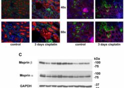 Meprin β distribution and its protein levels in kidney are altered in cisplatin treated mice