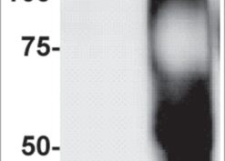HRP-neutravidin detection of biotinylated proteins in MIAPaCa-2 cell lysates