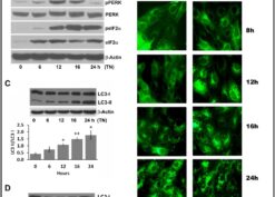 Induction of ER stress, UPR response, and autophagy by the pharmacological ER stress inducers tunicamycin and thapsigargin