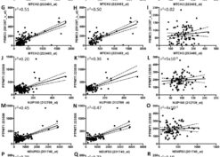 Correlation between expression of genes within the CELF1 locus is lost in AD brains