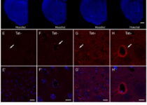 Effects of HIV-1 Tat expression on the penetration of horseradish peroxidase
