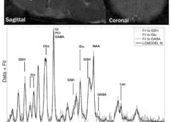 Conditional HIV-Tat protein expression induces depression-like e