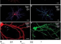 Structure of D1 and D2 receptor-expressing striatal MSNs in Tat− and Tat+ transgenic mice