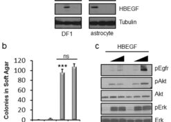 HBEGF promotes anchorage-independent growth of immortal astrocytes
