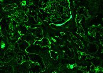 LDL Receptor-Related Protein 2