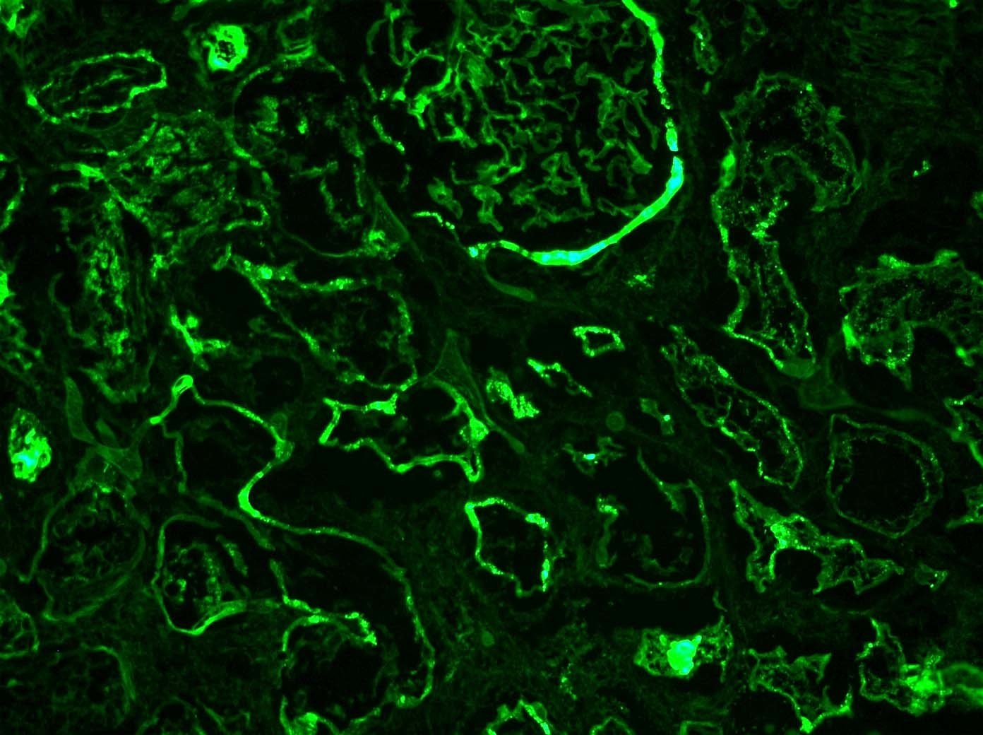 LDL Receptor-Related Protein 2