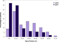 Distribution of patient age at biopsy