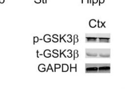 In vivo expression of Tat activates GSK3β and CaMKIIβ in multiple brain regions