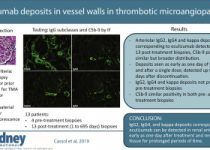 Eculizumab deposits in vessel walls in thrombotic microangiopathy