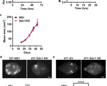 Syndecan-1 facilitates breast cancer metastasis to the brain