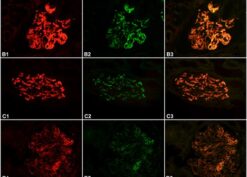 Indirect double immunofluorescence staining on paraffin-embedded tissue sections