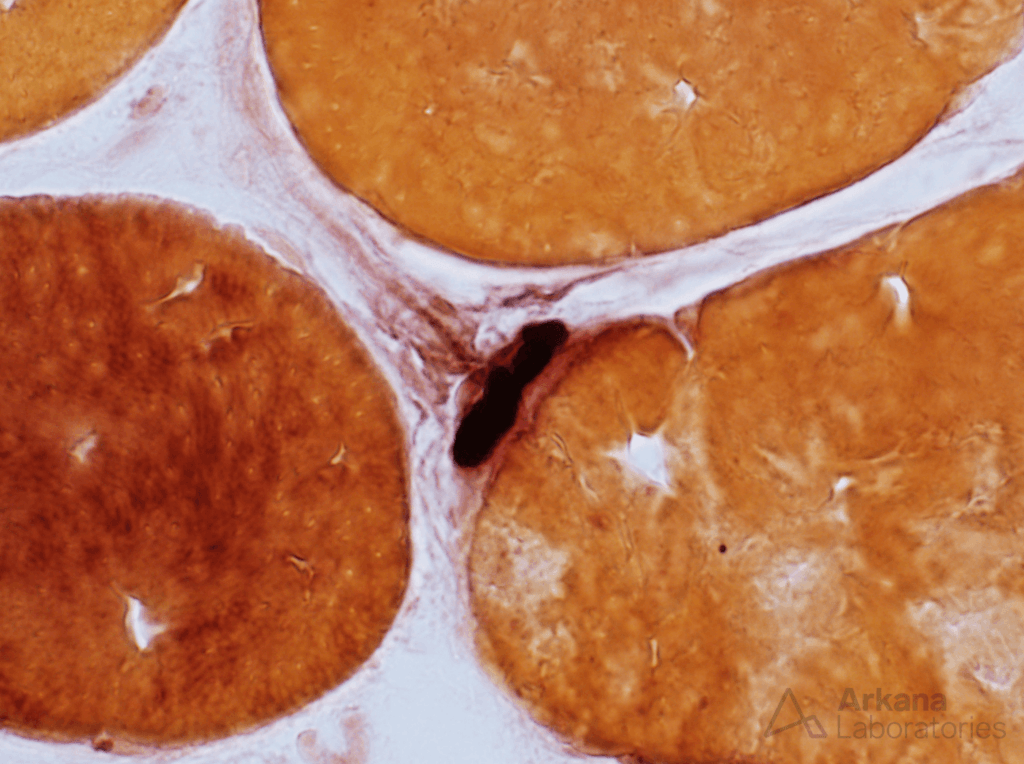 Neuromuscular Junction, NMJ, Neuro Pathology, myoneural junction, motor end-plate