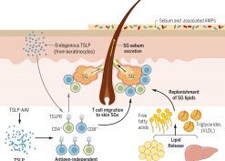 Thymic stromal lymphopoietin induces adipose loss through sebum hypersecretion