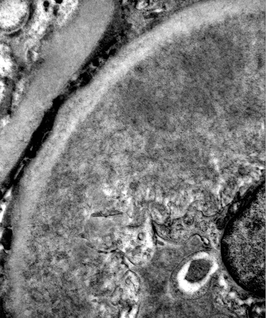 EM diagnostic image