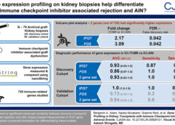 Gene Expression Profiling In Kidney Transplants
