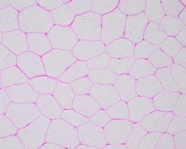 diagnostic image of nerve and muscle biopsy sent to arkana laboratories