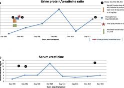 Complete biopsy-proven resolution of deposits in recurrent proliferative glomerulonephritis
