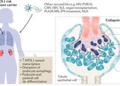 Proposed pathogenesis of COVAN.