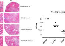 Histopathological analysis demonstrates reduced kidney damage in CKD mice supplemented with resistant starch.
