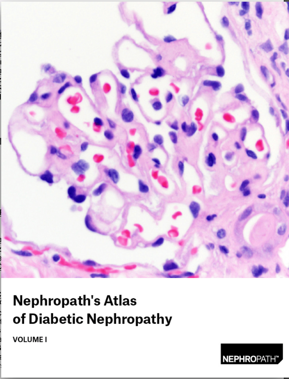 top cover of arkana laboratories e-book Nephropath's Atlas of diabetic nephropathy