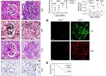 Progressive mesangioproliferative GN in Tnip1–/– mice