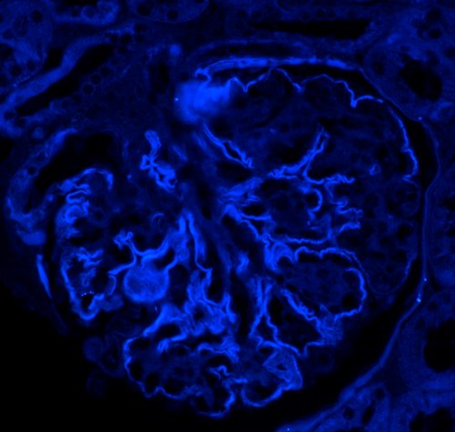 blue stain of glomerulus from a renal biopsy sent to arkana laboratories