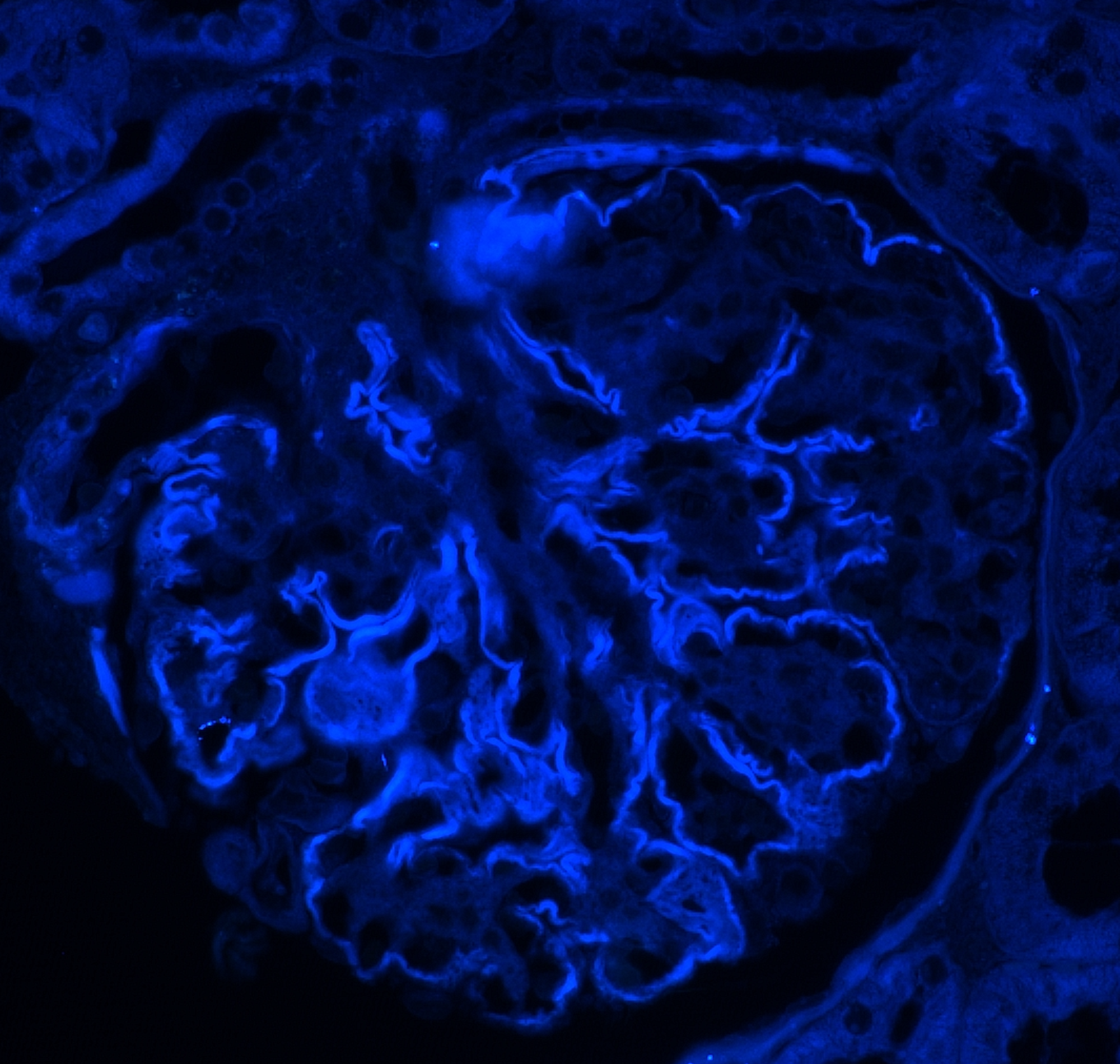 blue stain of glomerulus from a renal biopsy sent to arkana laboratories