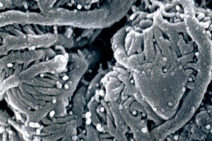 Glomerular Capillary Loop