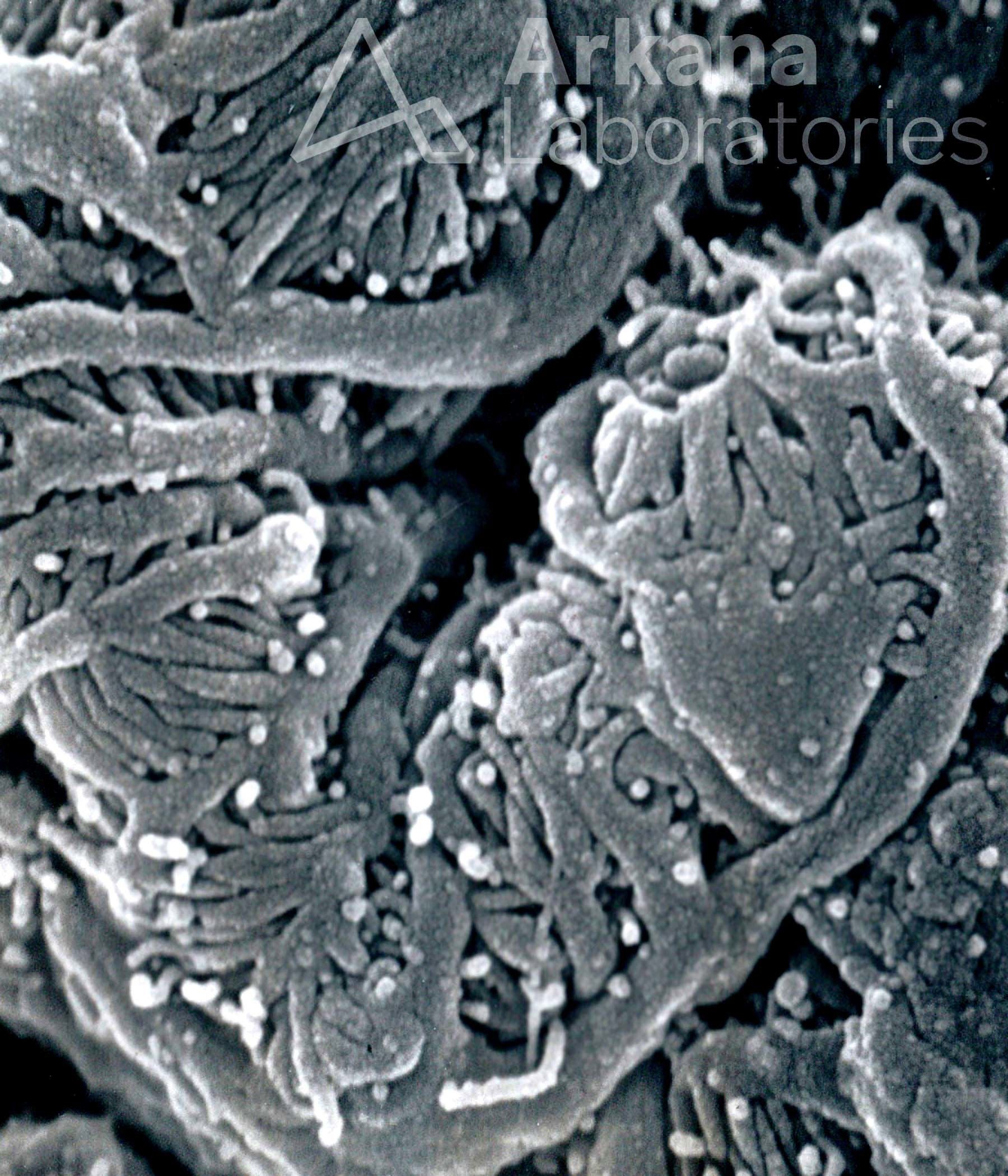 Glomerular Capillary Loop