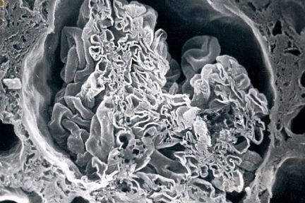 Origin of the Proximal Tubule From Bowman’s Capsule