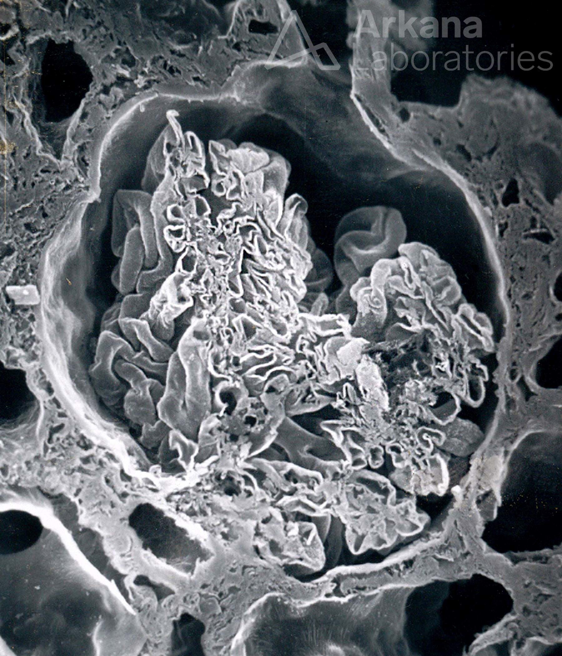 Origin of the Proximal Tubule From Bowman’s Capsule